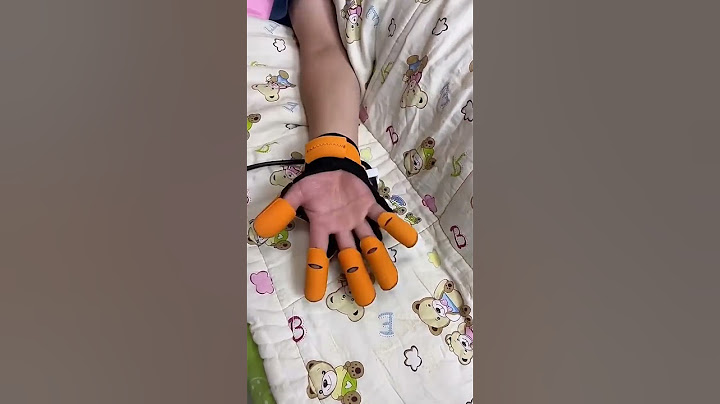 Finger Recovery Robot. 🔥Product Link in the Comments! 🔥