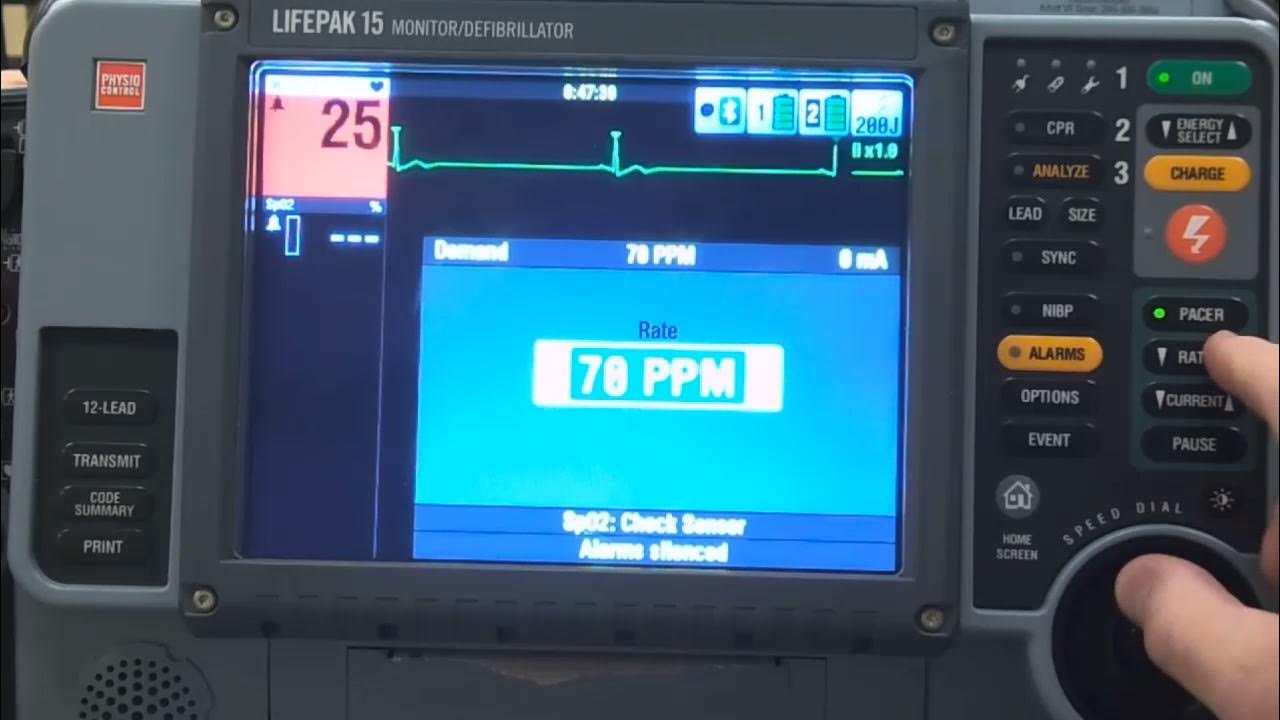 Pacing with LIFEPAK 15 YouTube