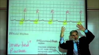 CARDIAC PHYSIOLOGY; PART 3 by Professor Fink.wmv