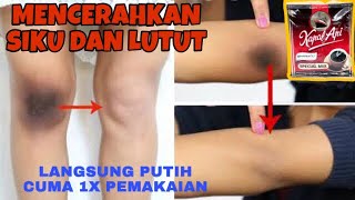 CARA MEMUTIHKAN LUTUT, SIKU, DAN LEHER DENGAN CEPAT!!