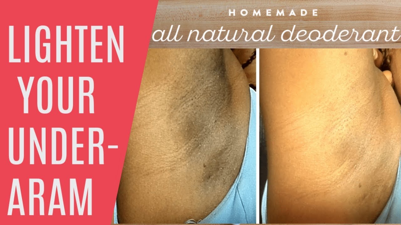 HOW TO LIGHTEN DARK UNDERARM - HOME MADE DEODORANT