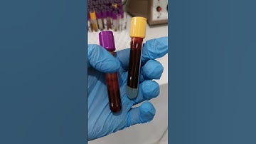 blood testing Laboratory life #lablife #laboratory #mls #cls #medtechstudent #medtech
