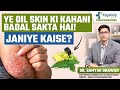 Ye Oil Psoriasis Skin Ki Kahani Badal Sakta Hai | Best Oil for Psoriasis Care | PTI