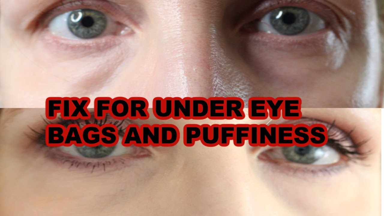 HOW TO GET RID OF BAGS UNDER EYES INSTANTLY! YouTube