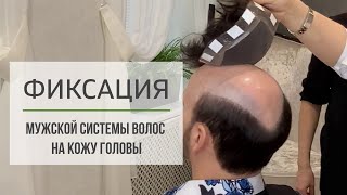 Фиксируем мужскую систему волос на кожу головы