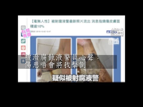 【短片】【有聲專欄】被潑腐蝕液警員心聲：傷患唔會將我擊倒