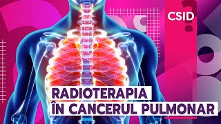 Radioterapia în cancerul pulmonar
