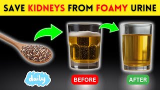 Top 10 SuperFoods to STOP PROTEINURIA Quickly and Heal Kidney Fast