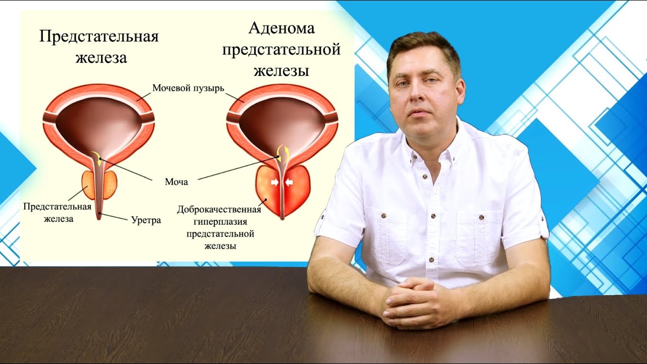 Дгпж в урологии. Аденома предстательной железы урология. Энуклеация аденомы простаты. Лазерная энуклеация аденомы простаты. Уролог Колосов.