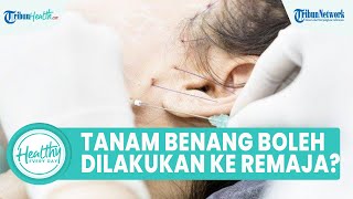 Apakah Tanam Benang Diperbolehkan Pada Remaja? Simak Ulasan Dari Dr Caryn