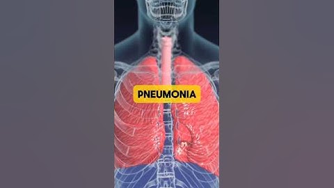 Pneumonia Explained in 40 Seconds 🫁 | Causes, Symptoms & Prevention | What is Pneumonia? #shorts