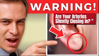 🔥 5 Silent Signs of Clogged Arteries You Should Never Ignore | Heart Disease Early Warning Symptoms