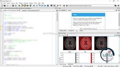 PYTHON 2021 Project - A Robust Brain Tumor Classification in MRI Images using Local Binary Pattern