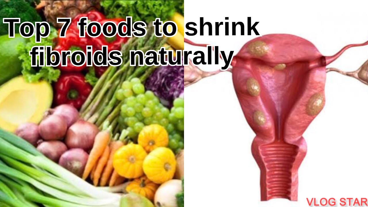 The Best Foods To Shrink Fibroids Naturally Fibroid Shrinking Foods Fibroid Home Remedies