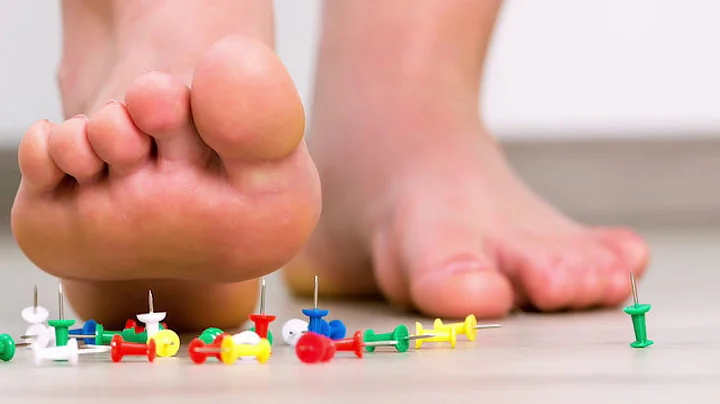Stretches for Plantar Fasciitis ...And more! | Roo...