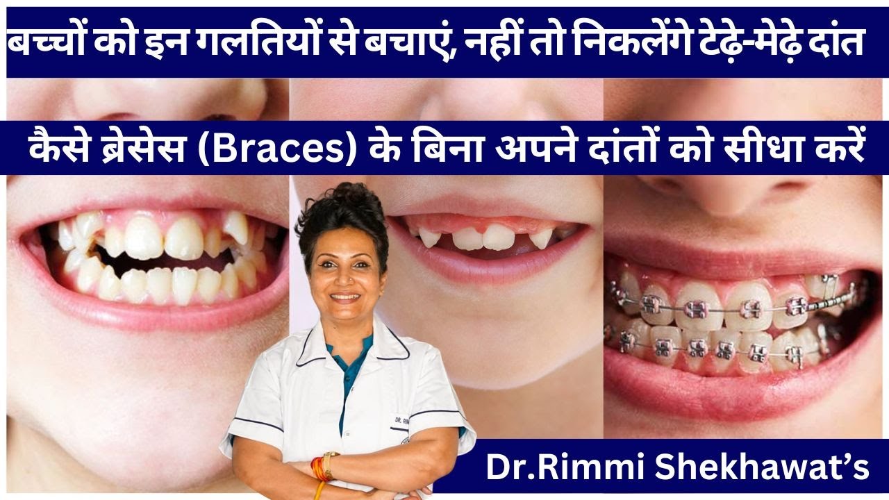 बच्चों को इन गलतियों से बचाएंनहीं तो निकलेंगे टेढ़े-मेढ़े दांत |बच्चों में टेढ़े मेढ़े दातों का ईलाज