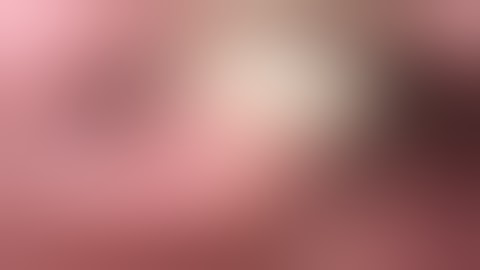 Tonsil stones reaction 25: The most common tonsil stones symptoms are bad breath.