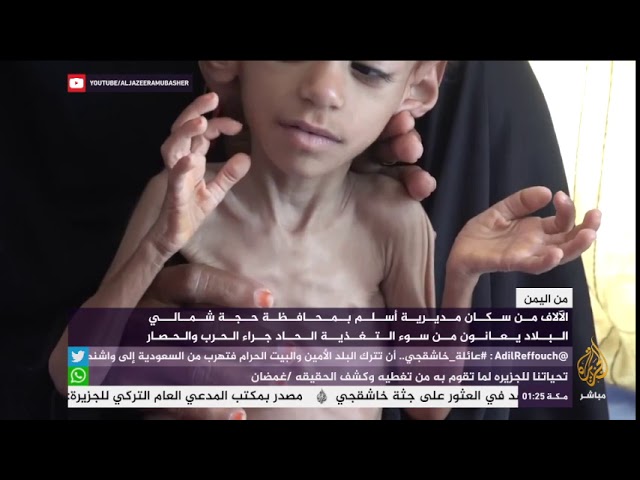مديرة مركز صحي بمحافظة حجة اليمنية : المرضى هياكل متحركة على الأسِرة