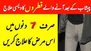 Peshab ke Qatron ka ilaj (پیشاب کے بعد قطرے آنا) | Mani ke Qatron ka ilaj