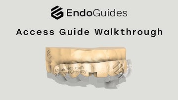 How to Use the Endo Guides Access Surgical Guide