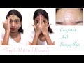 How to get rid of Small Bumps on Forehead&Bumpy Skin Quickly