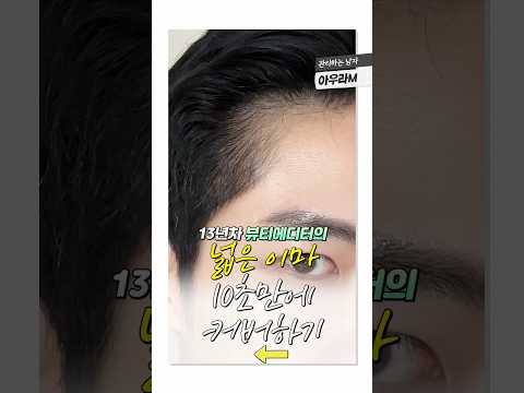 넓은 이마 10초만에 줄이기 #shorts