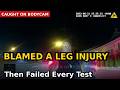 She Blamed a Leg Injury, Then Failed Every Test, Seaside Park NJ