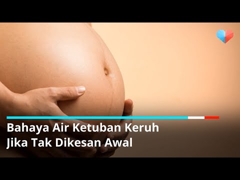 Video: Adakah Terdapat Risiko Kesihatan Untuk Menghentikan Pek Pertengahan Kelahiran?