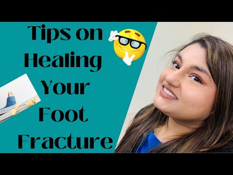 Tips on Healing Your Foot Fracture
