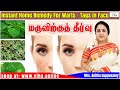Beauty Tips / Remedy For Warts - Tags /மருவிற்குத் தீர்வு / அனிதா குப்புசாமி / Anitha Kuppusamy
