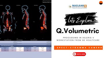 SPECT-CT processing with Q Volumetric Evolution in Xeleris Workstation