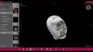 Volume - Athena DICOM Viewer
