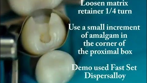 Class II Amalgam Restore for Clinic