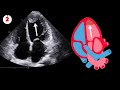 2D Echocardiography Cases: 7 Must-Know Cardiac Conditions for Students &amp; Clinicians