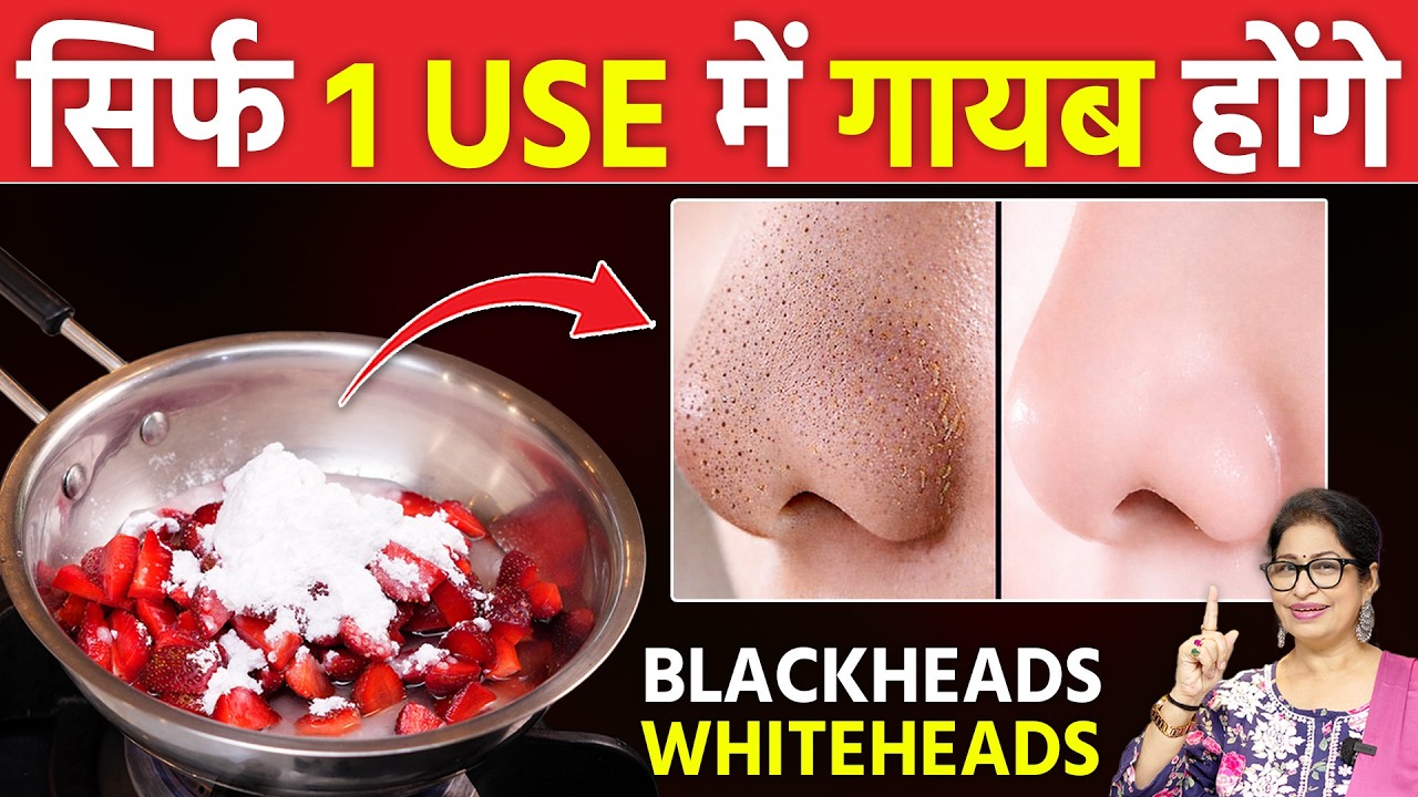 चेहरे के Blackheads, Whiteheads, Open Pores से मिलेगा 100% छुटकारा - 1 बार इस्तेमाल करें | DIY Scrub