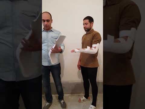 آموزش آتل بندی و نحوه بستن آتل بلند دست فومی آناتومیک یکبار مصرف موقت اورژانسی 