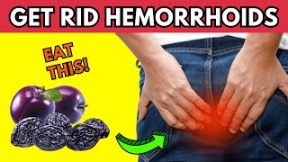 How to Get Rid of Hemorrhoids Naturally