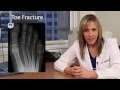 Buddy Splint for Toe Fractures - San Francisco Podiatrist