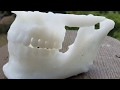 Tutorial: How to Create 3D Printable Dental and Orthodontic Models from Medical CT Scans