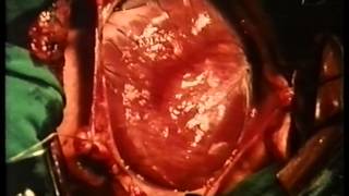 Bio-Bits 67 Vegetatief Zenuwstelsel