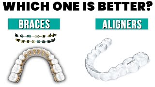 Invisalign, ClearCorrect, Clear Aligners or Braces? Which is Best?