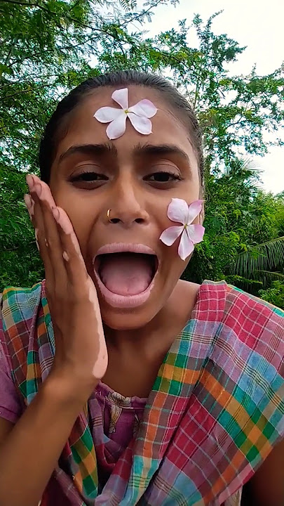 What ah oh with jelly eyball #funny#comedy #funnyfamily #shorts#3451