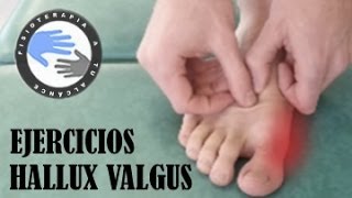 Masaje y ejercicios para juanetes o hallux valgus