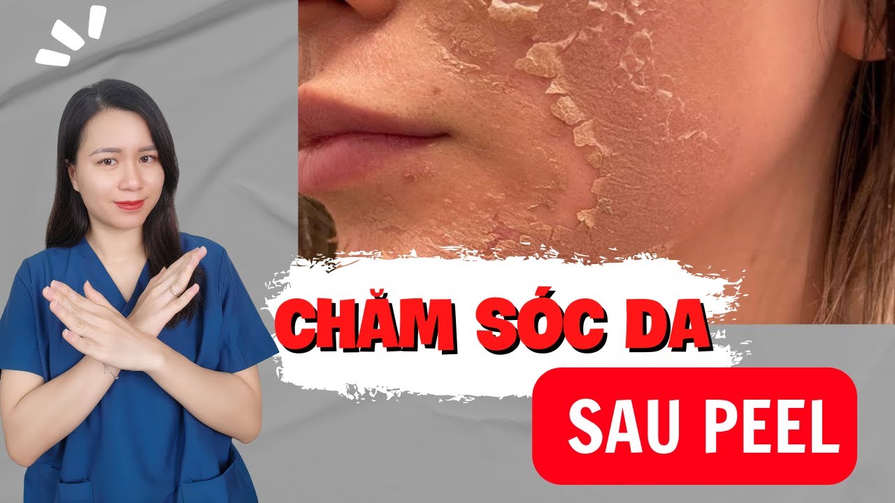 Khi nào cần gặp bác sĩ da liễu sau peel