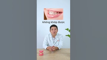 Chỉ niềng răng 1 hàm được không?