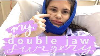 Double Jaw Surgery Day! + first days of recovery