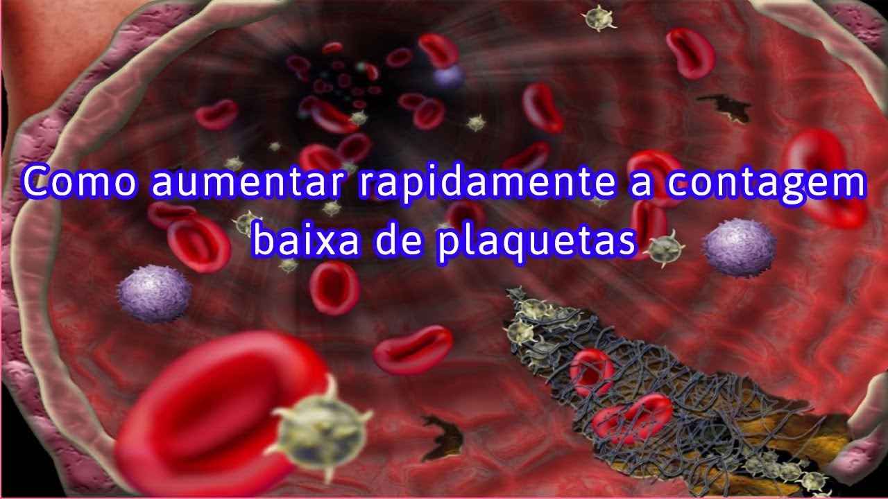 Oq E Plaqueta Baixa - FDPLEARN