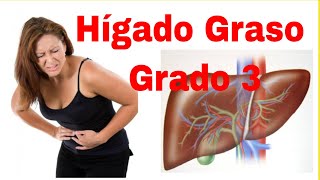 Higado Graso Grado 3