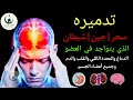 Ruqyah To Move A Possessing Entity From Head To Feet By Allah S Power 
