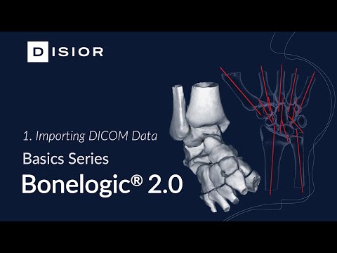 Bonelogic™ 2 Explained - 1. Importing DICOM Data